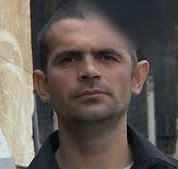 Elvis Romeo Lingurar, bărbatul cu jumătate de craniu